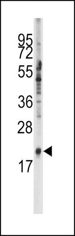 ANTI-SNRPC(C-TERMINAL) antibody produced in rabbit