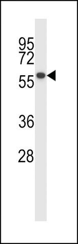 ANTI-PPM1D (CENTER) antibody produced in rabbit