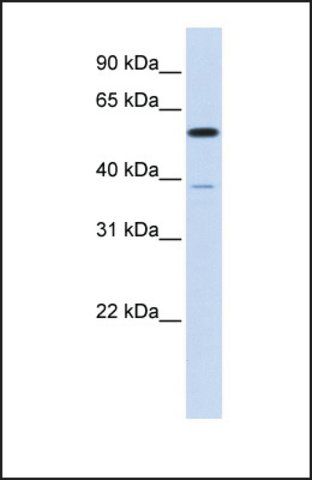 Anti-PPP2R5A, (N-terminal) antibody produced in rabbit