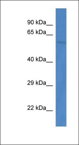 Anti-PPP3CB antibody produced in rabbit