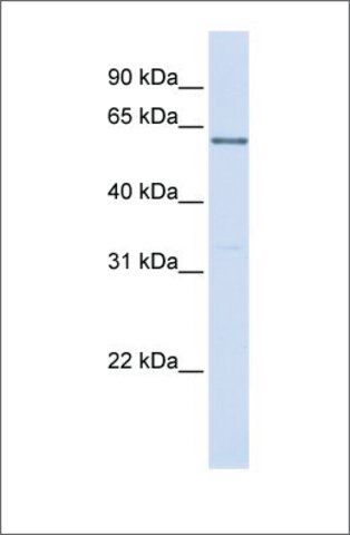 Anti-PPP2R3B antibody produced in rabbit