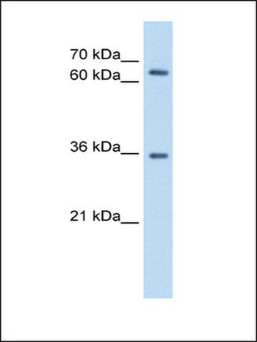 Anti-PPP2R3B antibody produced in rabbit