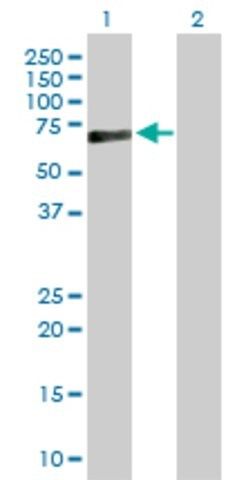 Anti-PRF1 antibody produced in rabbit