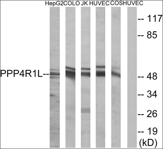 Anti-PPP4R1L antibody produced in rabbit