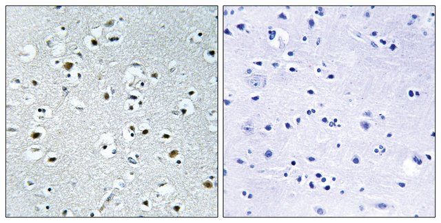 Anti-PPRC1 antibody produced in rabbit