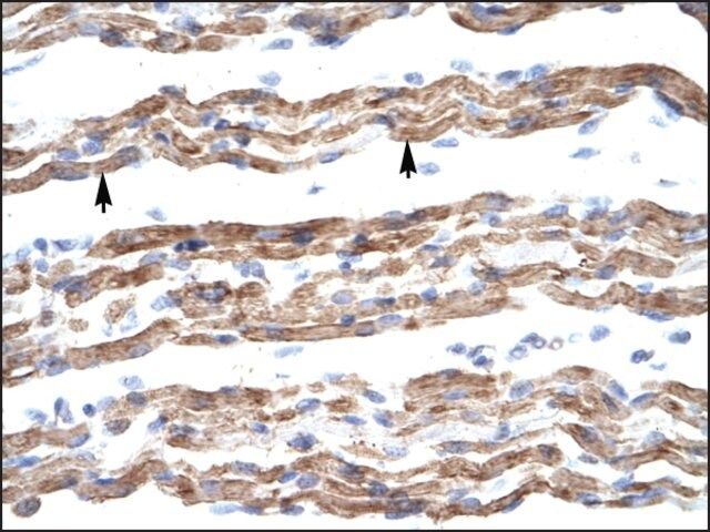 Anti-PQBP1 antibody produced in rabbit