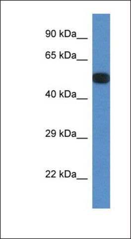 Anti-PPP2R5E antibody produced in rabbit