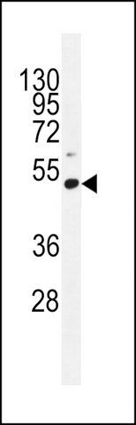 ANTI-PRAMEF10 (C-TERM) antibody produced in rabbit