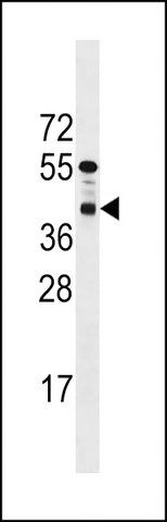 ANTI-PPTC7(C-TERMINAL) antibody produced in rabbit