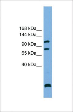 Anti-PPP6R1, (N-terminal) antibody produced in rabbit