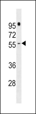 ANTI-PRAMEF16(C-TERMINAL) antibody produced in rabbit