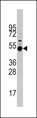 ANTI-PRAK (MAPKAPK5) (T182) antibody produced in rabbit