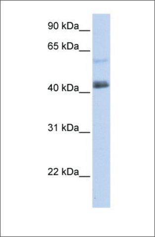 Anti-PRDM15 (ab1) antibody produced in rabbit