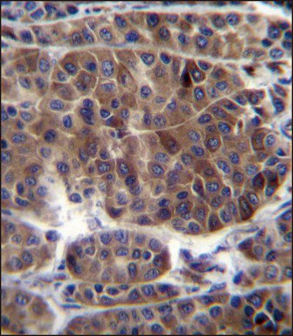 ANTI-PRAMEF3 (C-TERM) antibody produced in rabbit