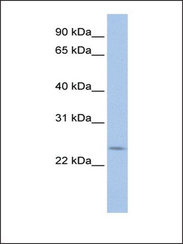 Anti-PRELID2 antibody produced in rabbit