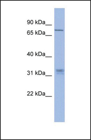 Anti-PRDM8 antibody produced in rabbit