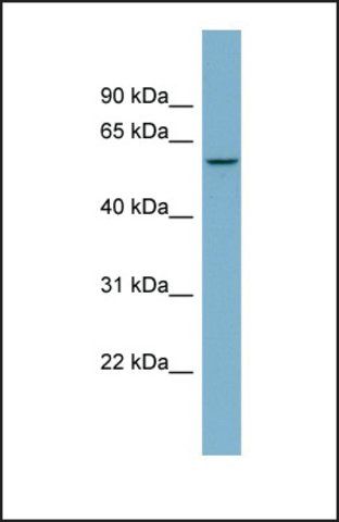 Anti-PPP5C, (N-terminal) antibody produced in rabbit