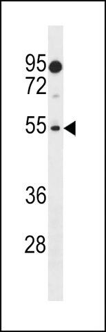 ANTI-PRAMEF18 (CENTER) antibody produced in rabbit