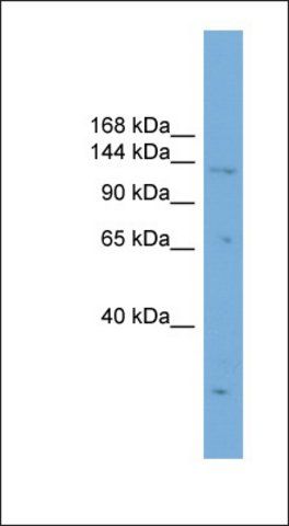 Anti-PRDM16 antibody produced in rabbit