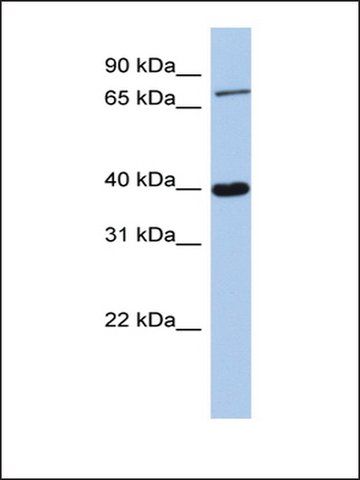 Anti-PRDM4 antibody produced in rabbit