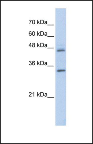 Anti-PRELP antibody produced in rabbit