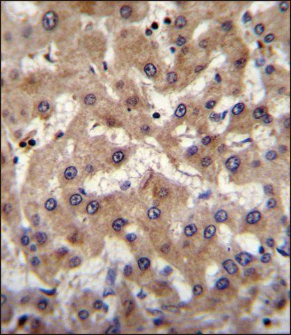 ANTI-PRAMEF6 (C-TERM) antibody produced in rabbit