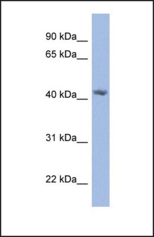 Anti-PRPSAP2, (N-terminal) antibody produced in rabbit