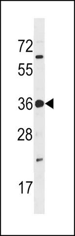 Anti-PRPK (center) antibody produced in rabbit