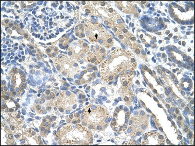 Anti-PRPS2 antibody produced in rabbit