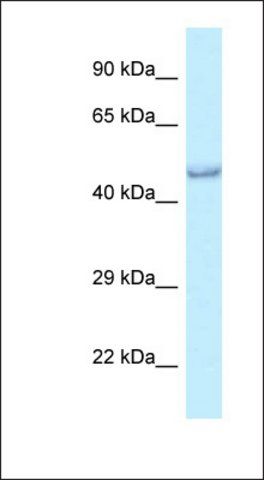 Anti-PRMT6 antibody produced in rabbit