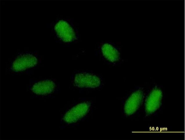 Anti-PRRX1 antibody produced in mouse