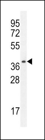 ANTI-PRSS3 (N-TERM) antibody produced in rabbit