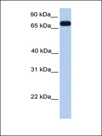 Anti-PRICKLE3 antibody produced in rabbit