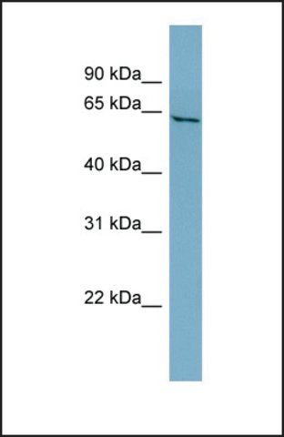 Anti-PRPH, (N-terminal) antibody produced in rabbit