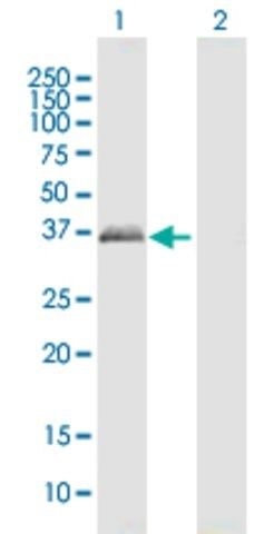 Anti-PRPH2 antibody produced in mouse