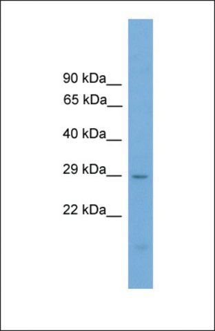 Anti-PRRX2 antibody produced in rabbit