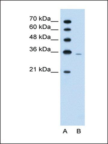 Anti-PRPS2 (AB2) antibody produced in rabbit