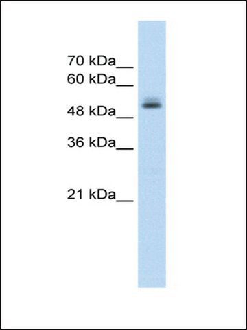 Anti-PRPF19 (AB1) antibody produced in rabbit