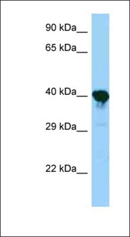 Anti-PRPSAP1 antibody produced in rabbit