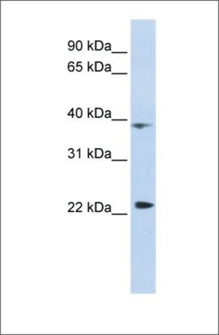 Anti-PRR11 antibody produced in rabbit