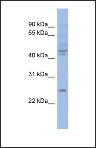 Anti-PROP1 antibody produced in rabbit