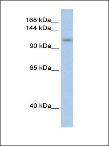 Anti-PRPF6 (AB1) antibody produced in rabbit