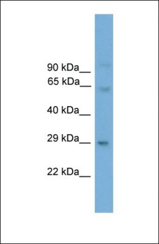 Anti-PRRX2, (N-terminal) antibody produced in rabbit