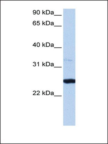 Anti-PRTFDC1 antibody produced in rabbit