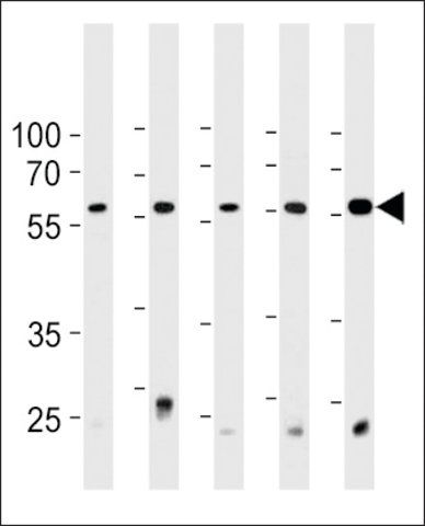 ANTI-PRS4(C-TERMINAL) antibody produced in rabbit