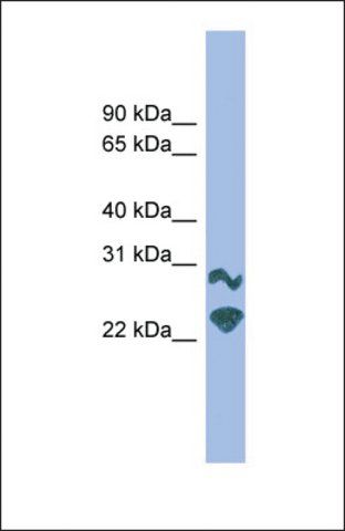 Anti-PRRXL1, (C-terminal) antibody produced in rabbit