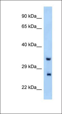 Anti-PRRG4 antibody produced in rabbit