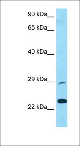 Anti-PRSS58 antibody produced in rabbit