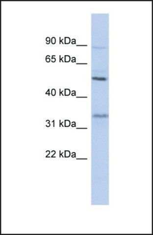 Anti-PRSS35, (N-terminal) antibody produced in rabbit