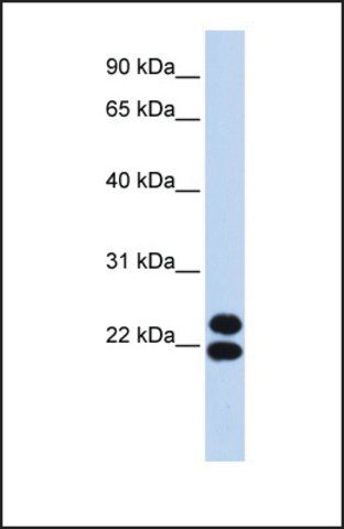 Anti-PRRX2, (N-terminal) antibody produced in rabbit